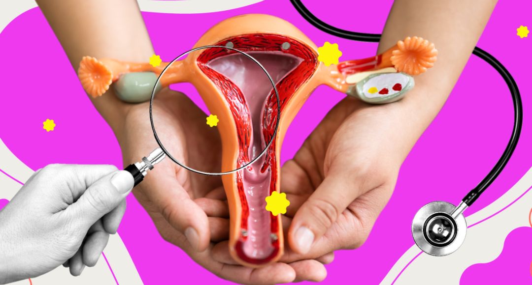 Wanneer is menstruatiepijn meer dan ‘normaal’? Alles over endometriose